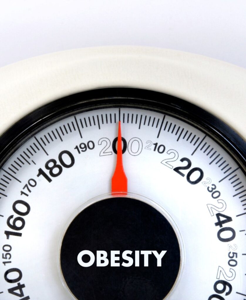 obesity-scale